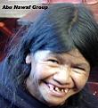 اضغط على الصورة لنسخة أكبر

الإسم:	SmileTeeth.jpg
القراءات:	108
الحجم:	44.9 KB
ID:	1647647