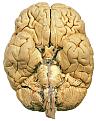 اضغط على الصورة لنسخة أكبر

الإسم:	Brain.jpg
القراءات:	75
الحجم:	123.4 KB
ID:	1648157